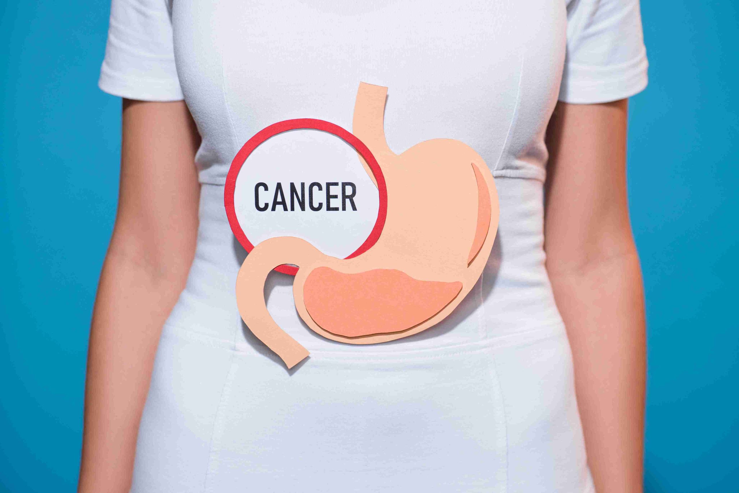 woman with cancer written on her stomach