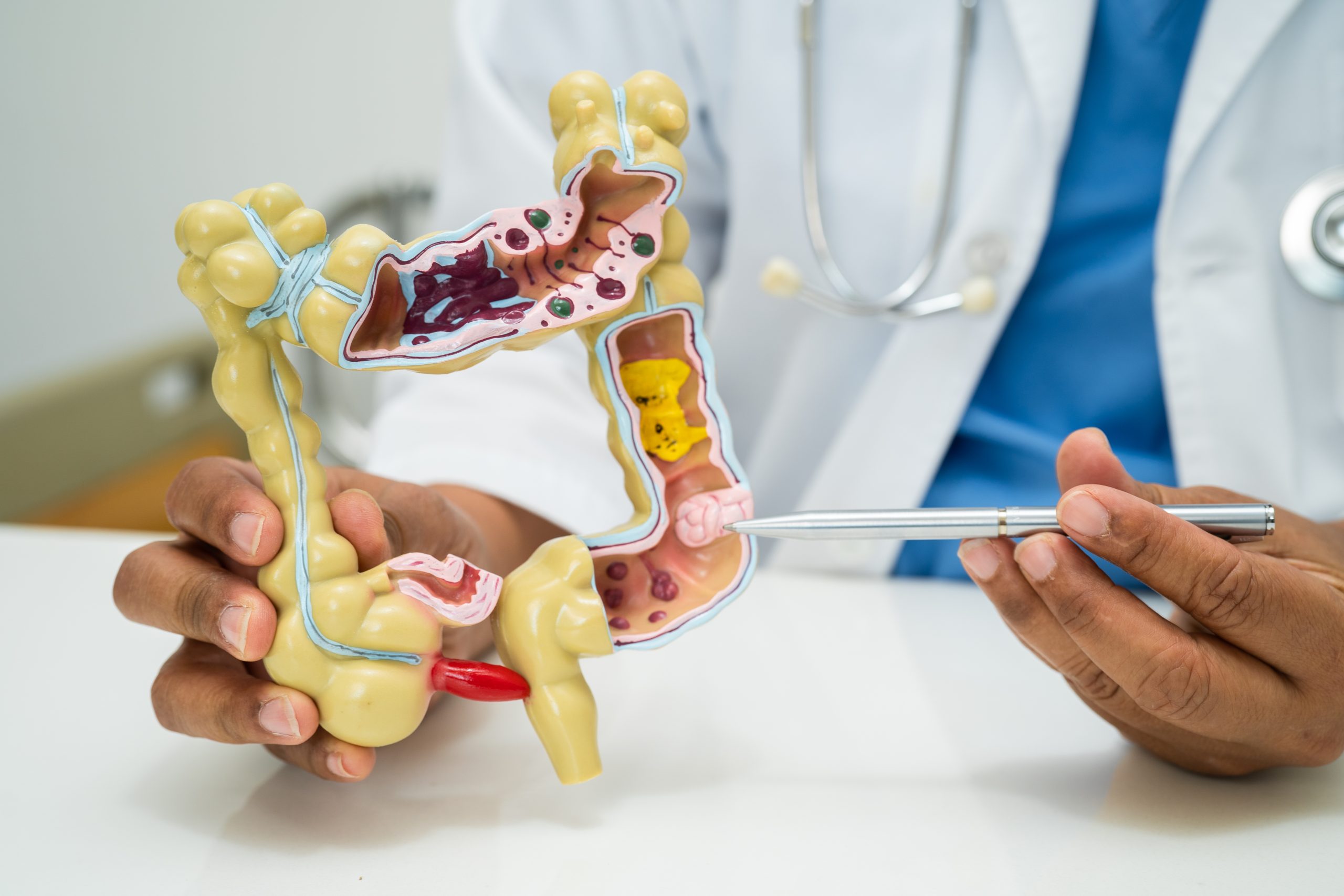 doctor holding anatomy model of intestine