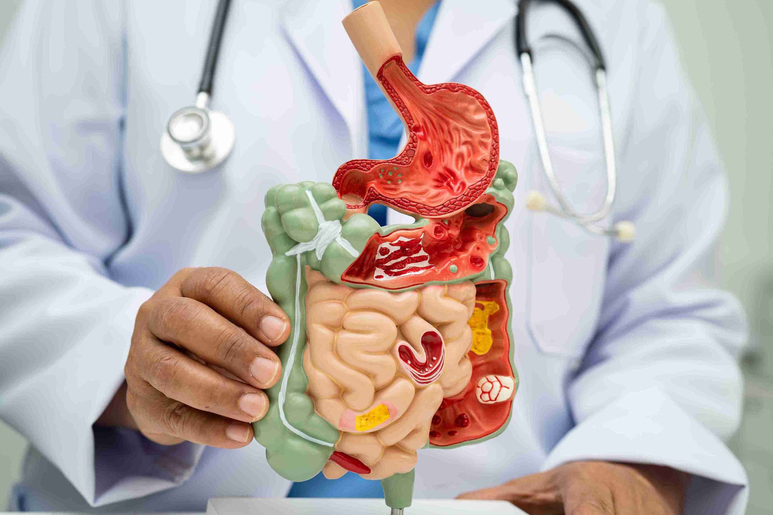 doctor showing a model of the digestive system