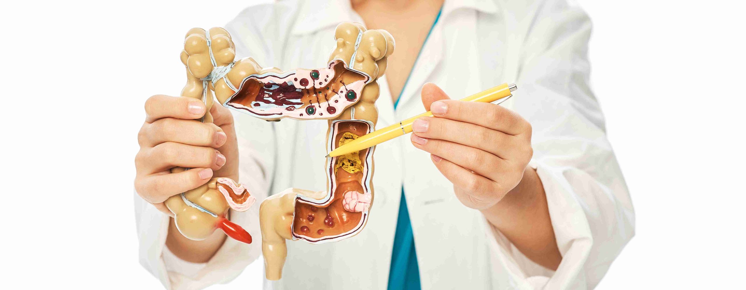 Healthcare worker showing an anatominal model of the intestine.
