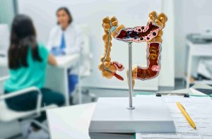 Common Mistakes in Colonoscopy Bowel Prep | Curasia