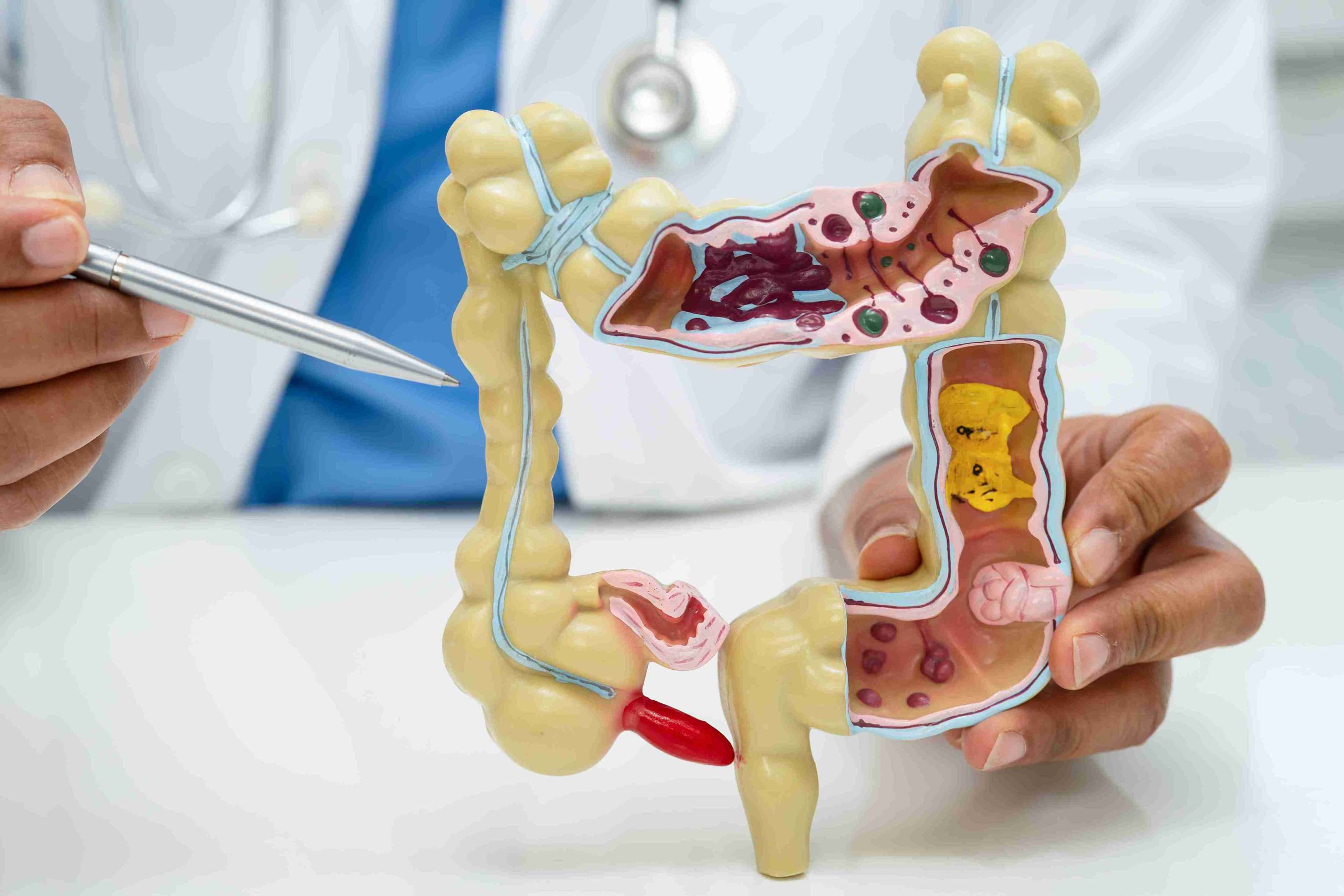 Healthcare worker holding a model of the intestine, appendix, and the digestive system.
