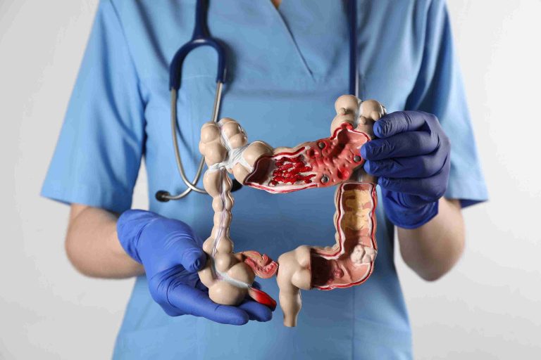 Gastroenterologist holding a model of the human colon.