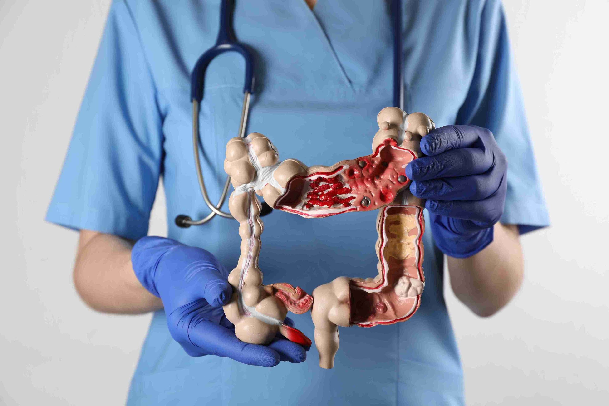 Gastroenterologist holding a model of the human colon.