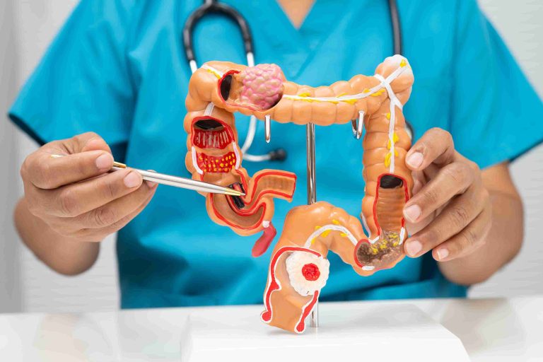 Healthcare worker holding a model of the human colon.