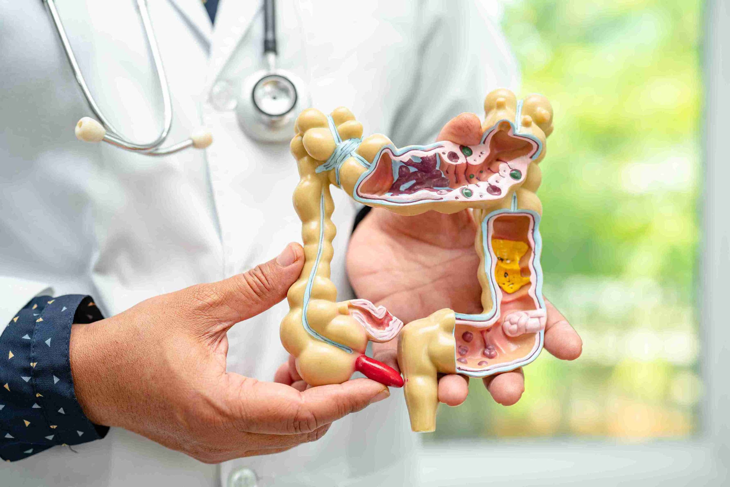 Healthcare professional holding an anatomical model of a human colon.