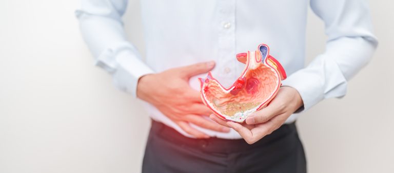 Man holding his stomach with one hand and an anatomical model of the stomach in the other.